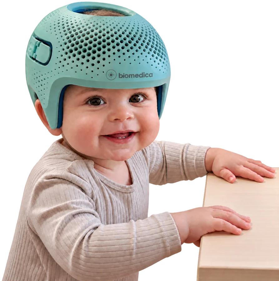 Bambino con caschetto cranico stampato in 3D